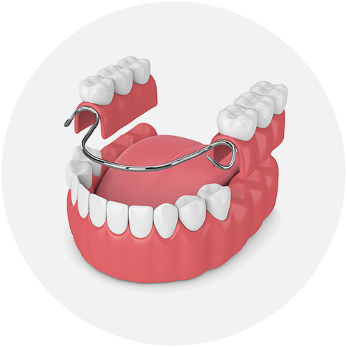 Dentures Dentures