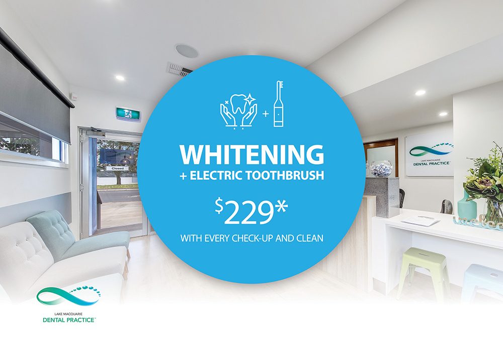 Teeth Whitening-Limited offer