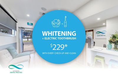 Teeth Whitening-Limited offer